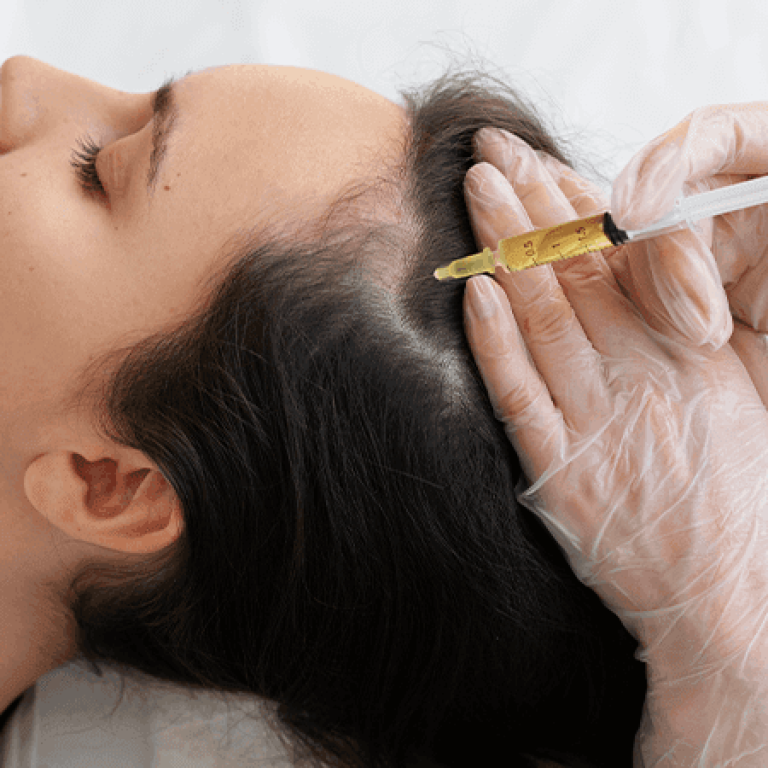 Ankara saç mezoterapisi