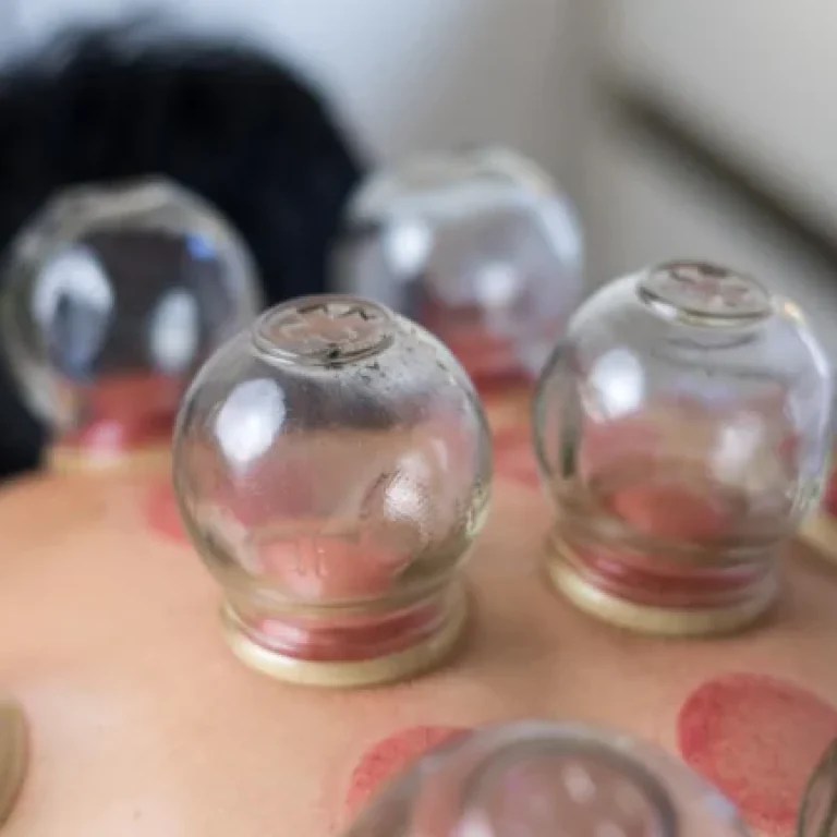 hacamat-sonrasi-dikkat-edilmesi-gerekenler